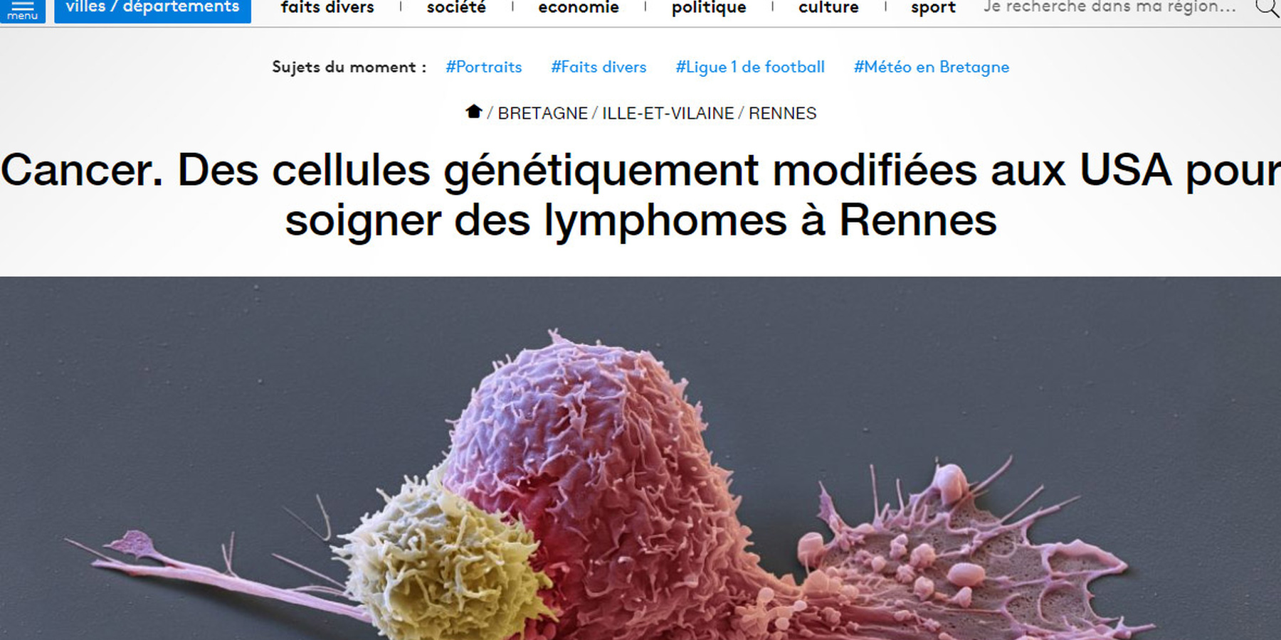 CAR-T cells, des cellules génétiquement modifiées aux USA pour soigner des lymphomes à Rennes